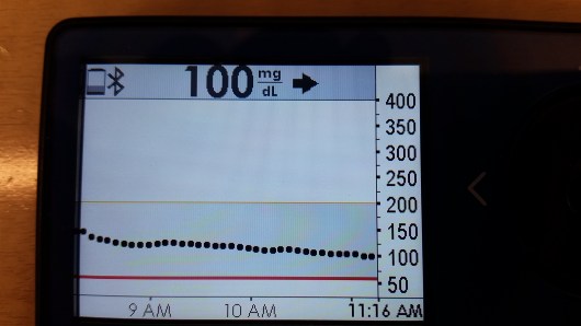 dexcom100
